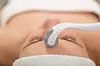 Microneedling Fotografija: Shutterstock
