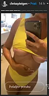 Chrissy je u svom IG storyju pokazala da ima svježe ožiljke na grudima.