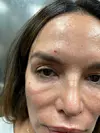 Severina Vučković na licu ima ogrebotine