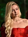 Supermodel ima gotovo savršenu čeljst