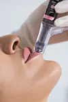 HydraFacial tretman je potpuno bezbolan i ne zahtijeva oporavak.