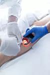 Liječenje vena radiofrekvencijskom metodom