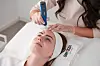 SkinPen je profesionalni uređaj za terapiju mikroglicima, jedini koji je odobrila FDA (Američka agencija za hranu i lijekove)