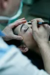 Danas vrlo često čujemo da se razne Rf, laserske i ostale neinvazivne tehnike na licu nazivaju faceliftingom.