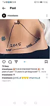 Objava na Instagramu kao znak potpore svim oboljelim ženama: Nika ja na svom trbuhu markerom povezala ožiljke od operacije 2015.