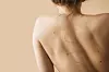 Pregled madeža u Sinteza Skin Clinic se može odviti uz pomoć dermatoskopa, ali i FotoFindera
