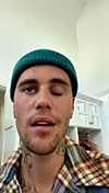 Justin Bieber u rujnu je objavio je da zbog rijetkog sindroma trpi djelomičnu paralizu lica