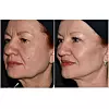 Stručni tim Poliklinike Lohuis Filipović Medical Group ocijenio je kako je profesorica najbolja kandidatkinja za LF Full Face makeover.