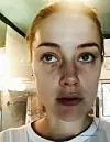 These harrowing photographs show injuries Amber Heard claims she sustained at the hands of her then-husband Johnny Depp after telling him she was going to leave him. The photos filed at a court in Virginia by Heards legal team form part of a bombshell dossier as a rebuttal to Depps million defamation lawsuit against his former wife. Graphic images show Amber with facial abrasions, bruises, and clumps of hair missing following an incident which allegedly happened days before Christmas in Los Angeles in December 2015, just nine months after the pair married. In the deposition Amber, 32, claims Depp, 55, attacked her at their Los Angeles penthouse before friends were due to arrive She claims that at one point he dragged her by the hair, onto their marital bed, and beat her while screaming: 'I'll f*****g kill you, you hear me?'� Describing what happened next, Heard claims in the legal document: 'Hoping to avoid the violence, I tried to calm Johnny down, and then went upstairs to try to remove myself from the situation. 'Johnny followed me, hit me in the back of my head, grabbed me by my hair again, got in front of me on the steps, and then dragged me by my hair up the last few steps.� 'At the top of stairs, Johnny shoved me twice, which made me fear I would fall. I told Johnny that he had broken my wrist in an attempt to get him to stop. 'Johnny kept hitting me, and each time he knocked me down, I chose to react by simply standing up and looking him in the eye. Johnny responded by yelling: