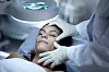 Duboki face lifting trenutno uživa veliku popularnost