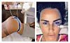 Povijest estetskih zahvata Katie Price može se pratiti na njenim društvenim mrežama