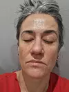 Danas, mjesec dana kasnije i dva tretmana kasnije, razlika je drastična